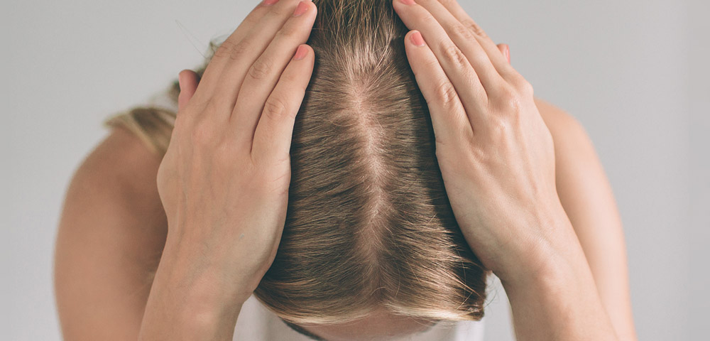 Haarausfall kann viele Ursachen haben Haarscheitel von oben