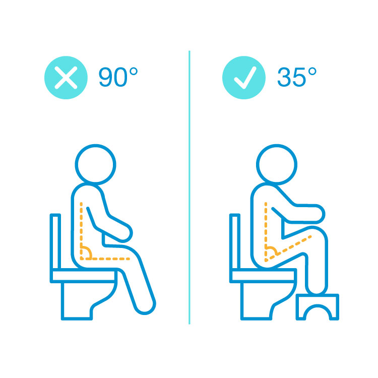 Korrekte Sitzposition auf der Toilette mit Hocker