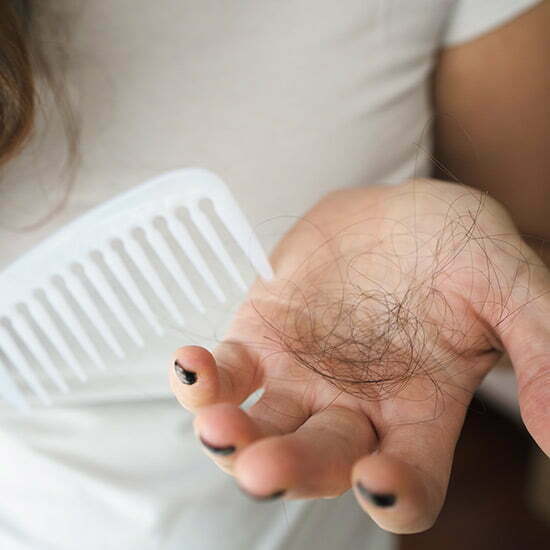 Frau mit ausgefallenen Haaren in der Hand